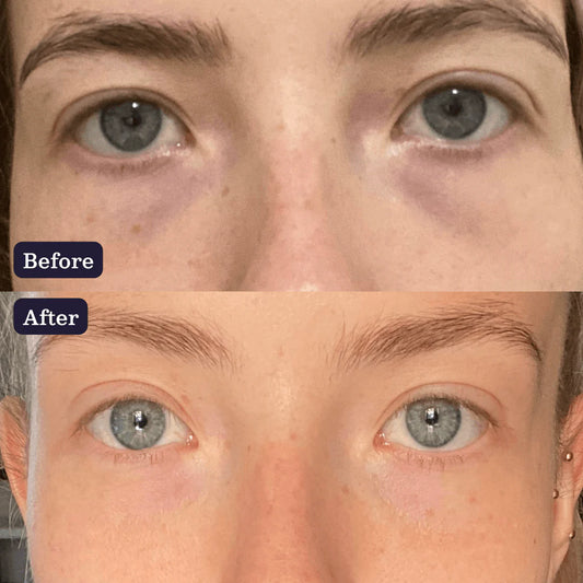 水鑽明眸亮眼精華液 15ml